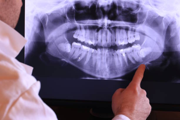 Best Root Canal Emergency Dentist  in Newton, MA